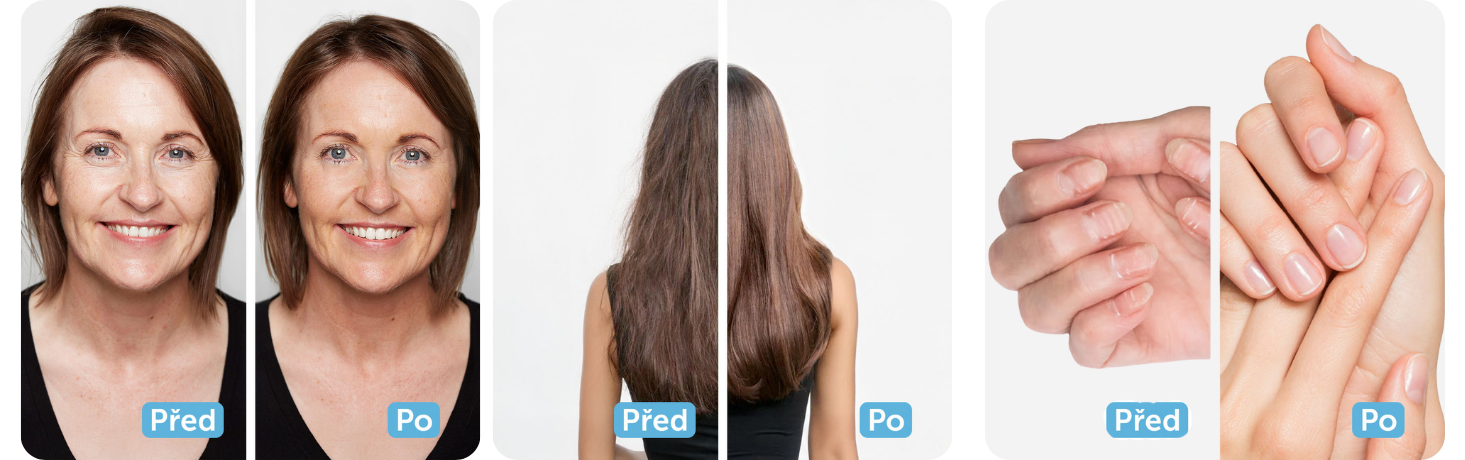 Banner před a po Collamedic